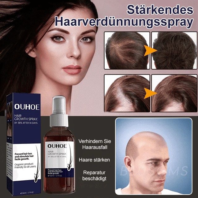🔥Hot sale 50%OFF🔥Natural Hair Regrowth Spray