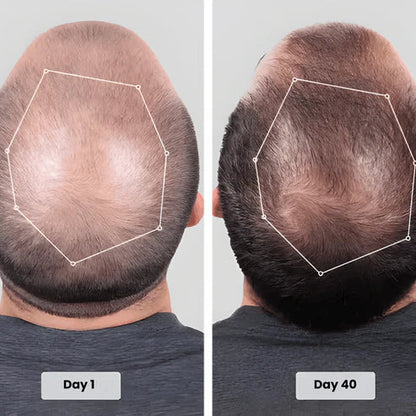 Red Light Therapy Cap for Hair Regrowth Treatment