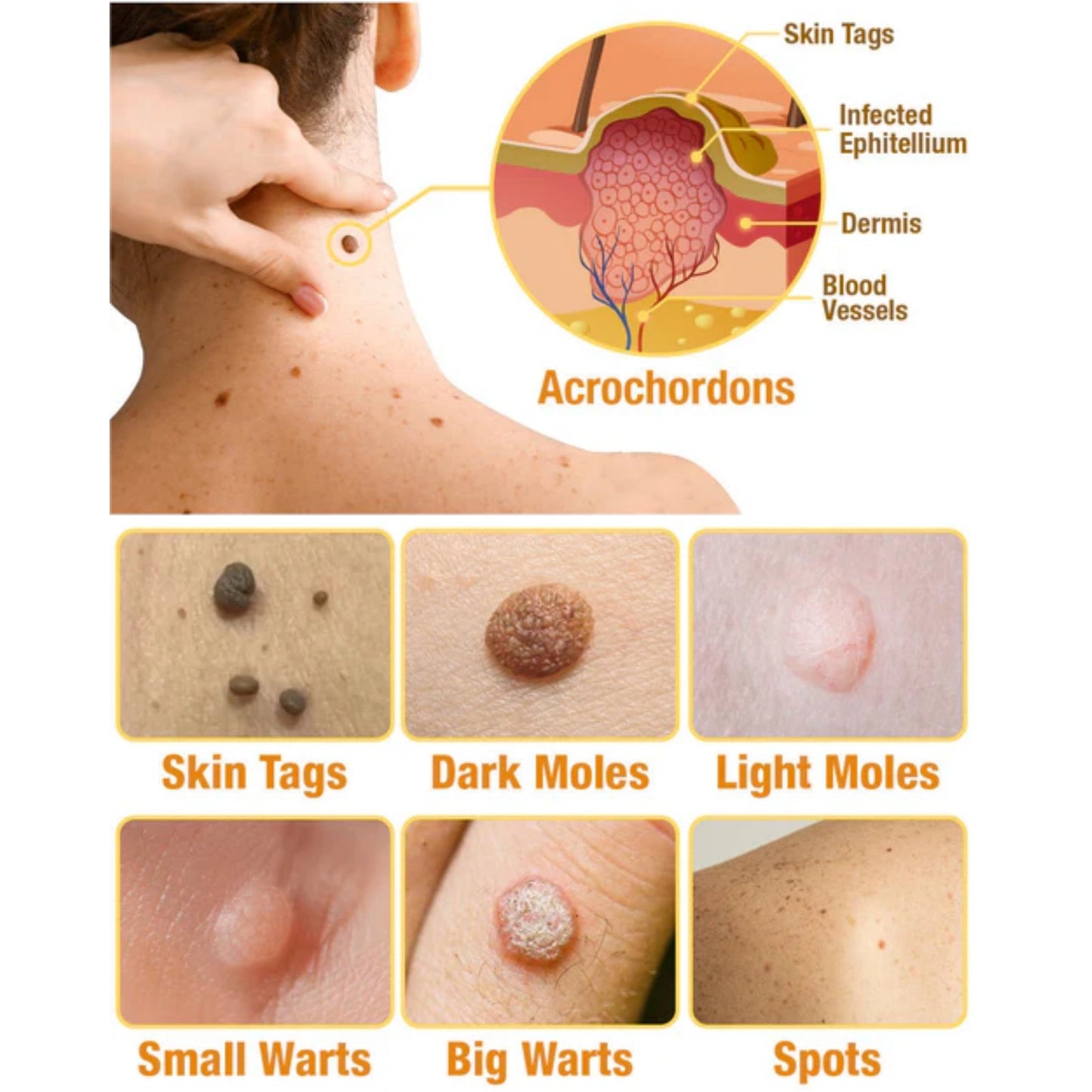 🐝LOVILDS TagRecede Bee Venom Treatment Spray