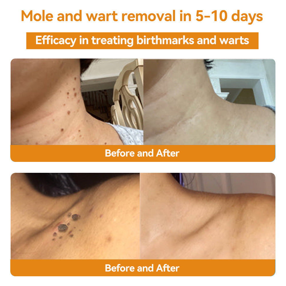 🐝LOVILDS TagRecede Bee Venom Treatment Spray