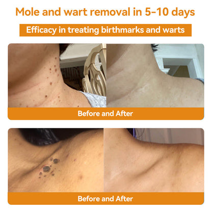 🐝LOVILDS TagRecede Bee Venom Treatment Spray