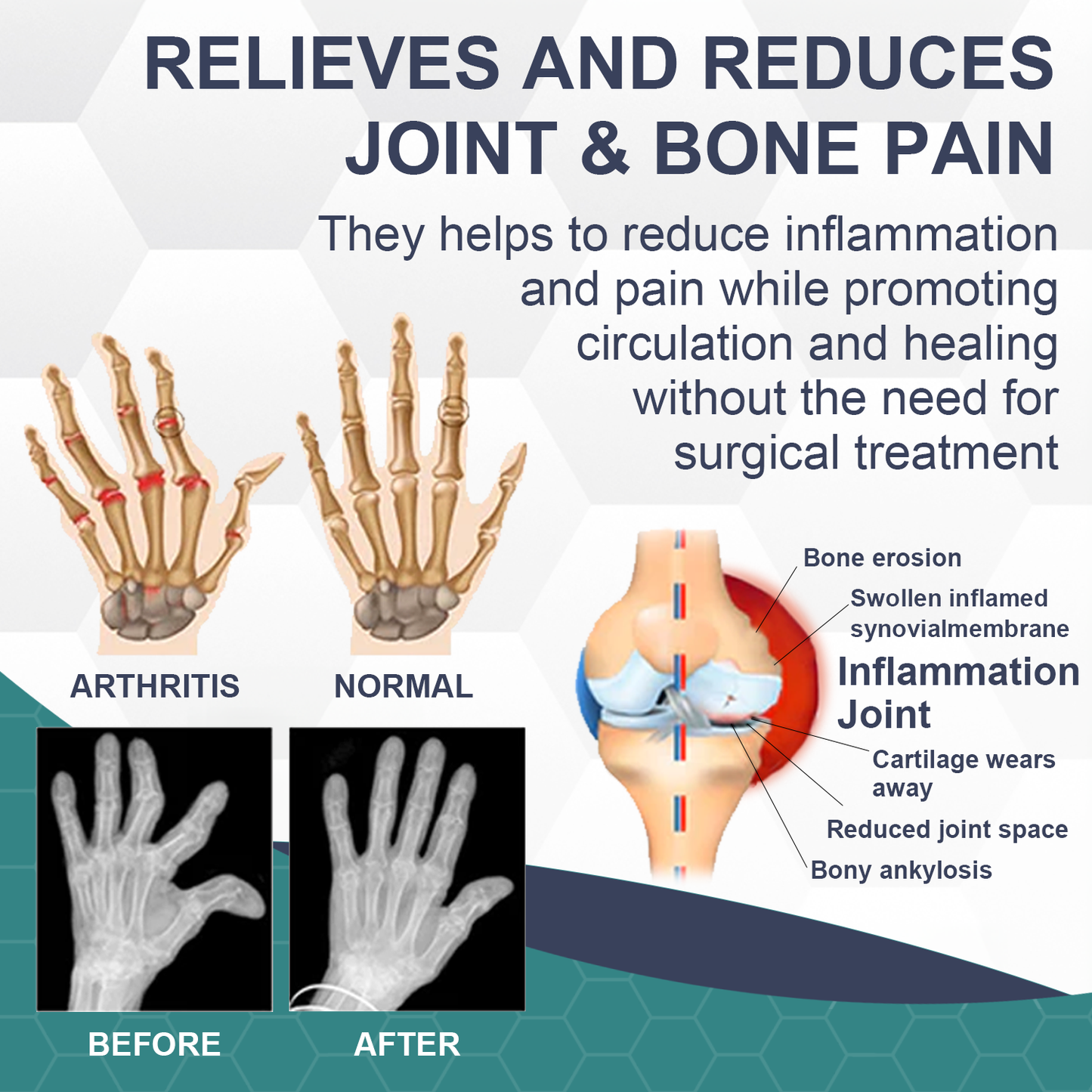 🐝New Zealand Bee Venom Joint Bee Venom Pain and Bone Healing Cream