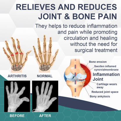 🐝New Zealand Bee Venom Joint Bee Venom Pain and Bone Healing Cream