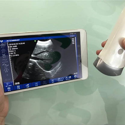 Portable Wireless Veterinary Ultrasound Scanner for Pregnancy Diagnosis – Handheld Probe Compatible with iOS & Android, for Pigs and Sheep