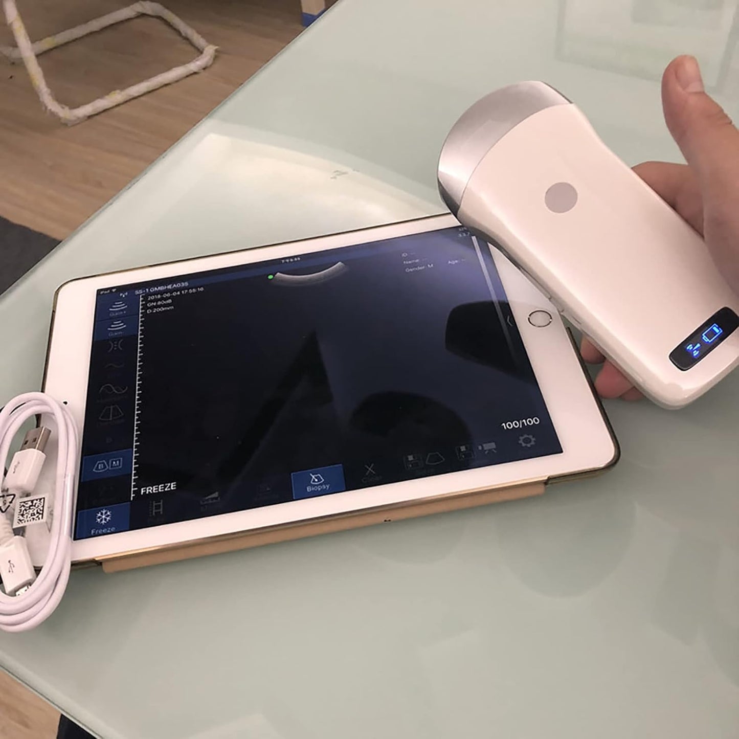 Portable Wireless Veterinary Ultrasound Scanner for Pregnancy Diagnosis – Handheld Probe Compatible with iOS & Android, for Pigs and Sheep