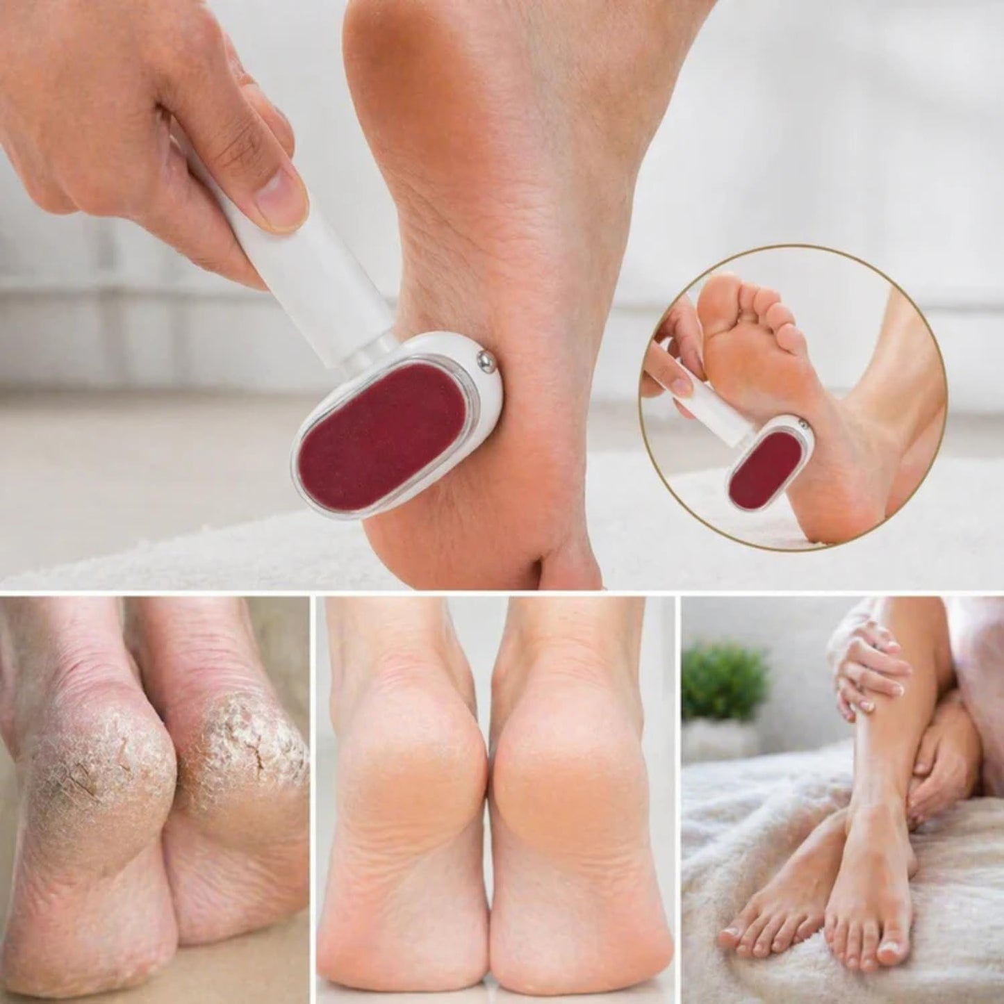 🦶 One-Pass Callus Peeler