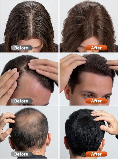 Red Light Therapy Cap for Hair Regrowth Treatment