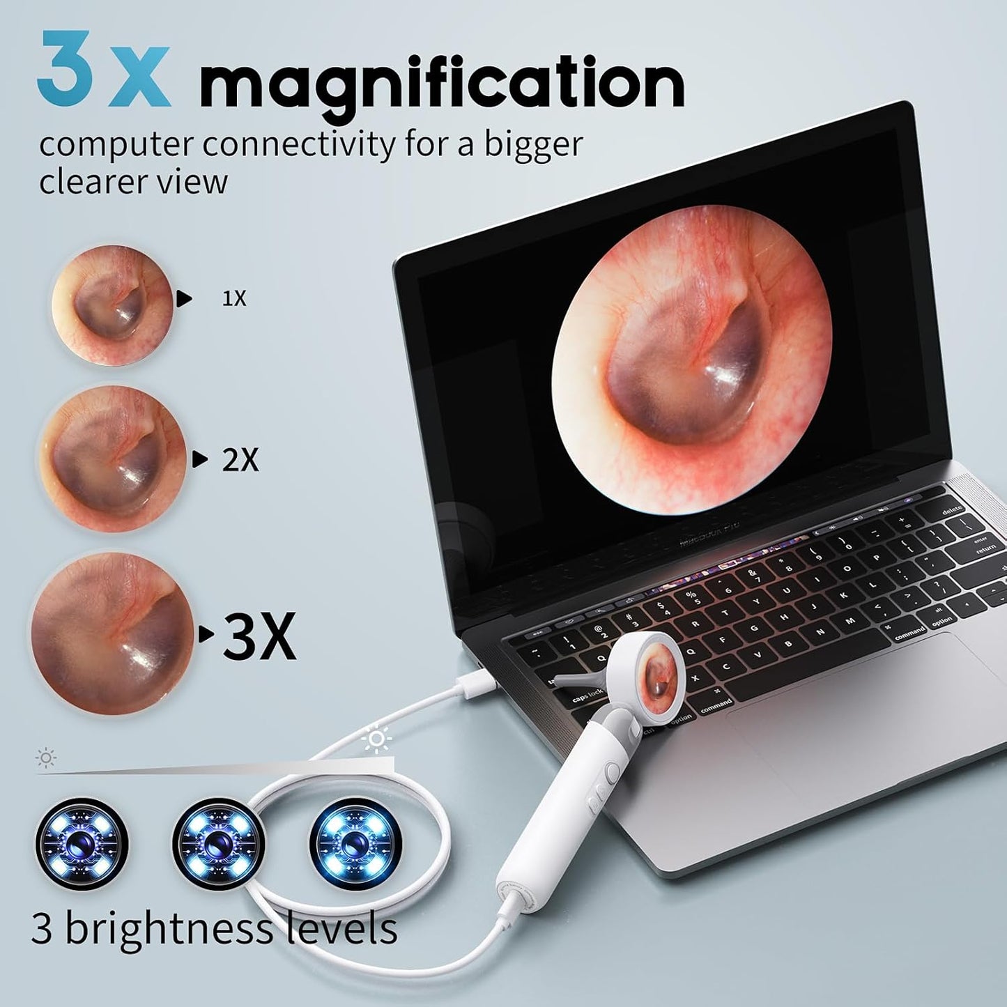 1080P HD Otoscope Ear Camera for Family