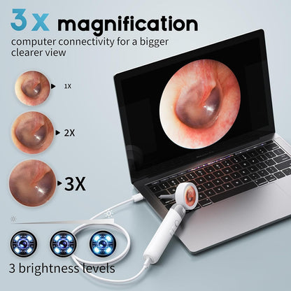 1080P HD Otoscope Ear Camera for Family