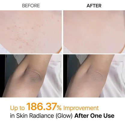 Body Peel Shot Spray
