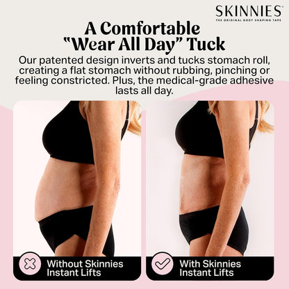 Skinnies Instant Lifts Tummy Tuck Tape – Clear Body Tape for Women, Slim Belly 3–4 Inches Instantly, Patented No-Pinch Adhesive, Sweatproof & All-Day Wear – 5 Pack, Made in USA