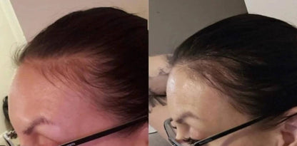 GROWING SEASON - BURDOCK HAIR GROWTH OIL
