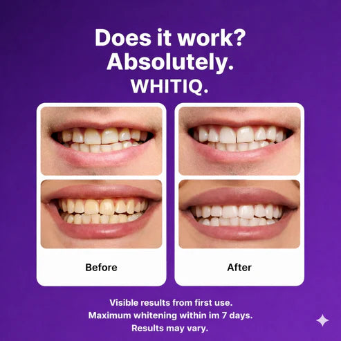 Color-Correct Whitening Strips