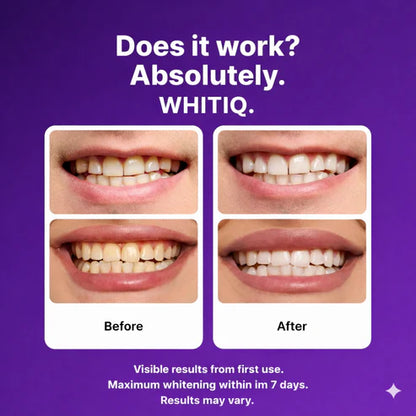 Color-Correct Whitening Strips