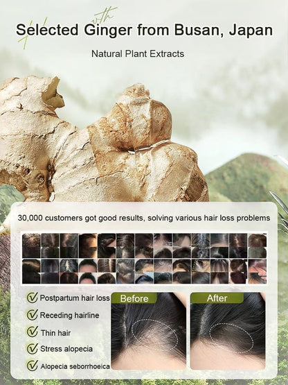 🔥New Year Sale 50% OFF🔥Hot Sale Ginger Plant Extract Anti-Hair Loss Hair Shampoo-No.1 Patent Sales in Japan