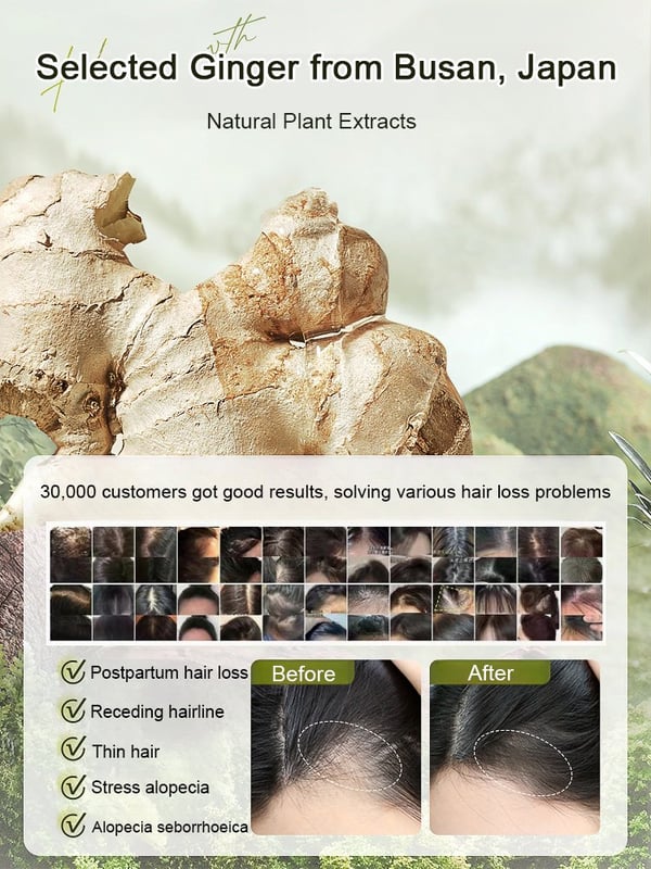 🔥New Year Sale 50% OFF🔥Hot Sale Ginger Plant Extract Anti-Hair Loss Hair Shampoo-No.1 Patent Sales in Japan