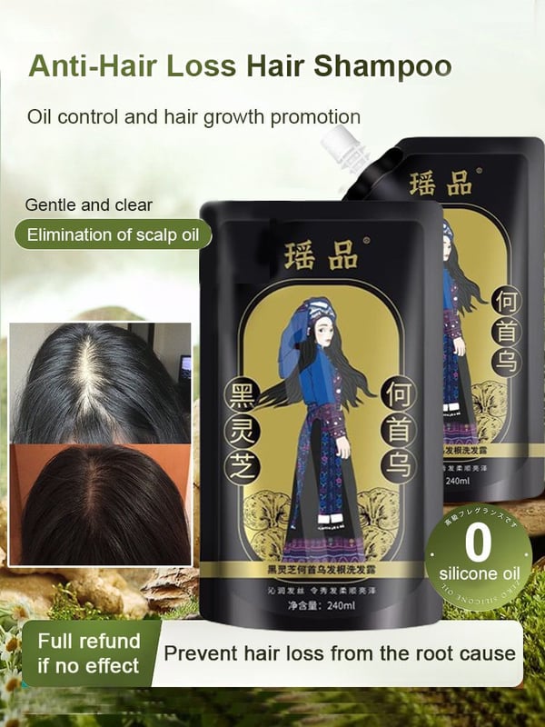 🔥New Year Sale 50% OFF🔥Hot Sale Ginger Plant Extract Anti-Hair Loss Hair Shampoo-No.1 Patent Sales in Japan