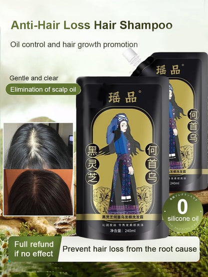 🔥New Year Sale 50% OFF🔥Hot Sale Ginger Plant Extract Anti-Hair Loss Hair Shampoo-No.1 Patent Sales in Japan