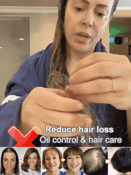 🔥New Year Sale 50% OFF🔥Hot Sale Ginger Plant Extract Anti-Hair Loss Hair Shampoo-No.1 Patent Sales in Japan