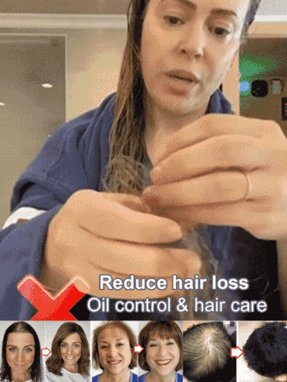 🔥New Year Sale 50% OFF🔥Hot Sale Ginger Plant Extract Anti-Hair Loss Hair Shampoo-No.1 Patent Sales in Japan