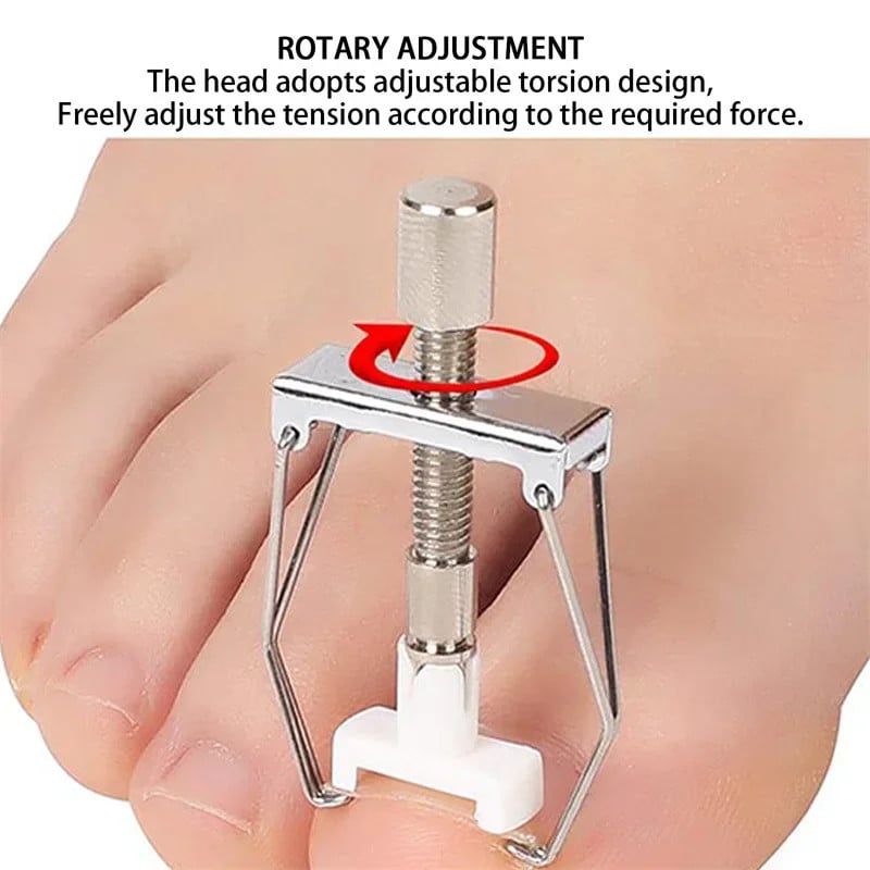 Ingrown Toenail Corrector Tool