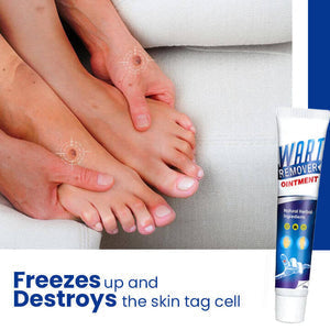 Instant Blemish Removal Cream