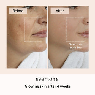 LED FACE & NECK MASK