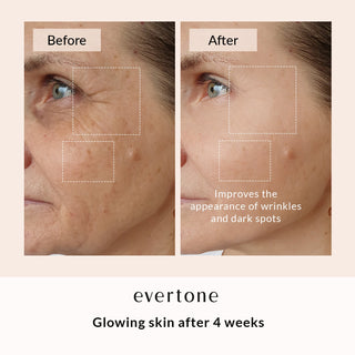 LED FACE & NECK MASK