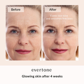 LED FACE & NECK MASK