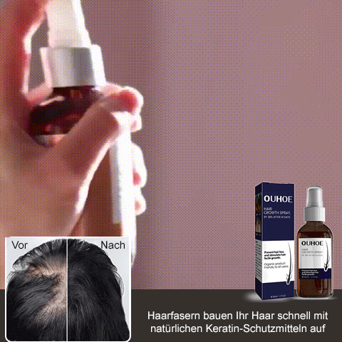 🔥Hot sale 50%OFF🔥Natural Hair Regrowth Spray