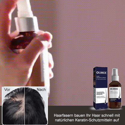 🔥Hot sale 50%OFF🔥Natural Hair Regrowth Spray