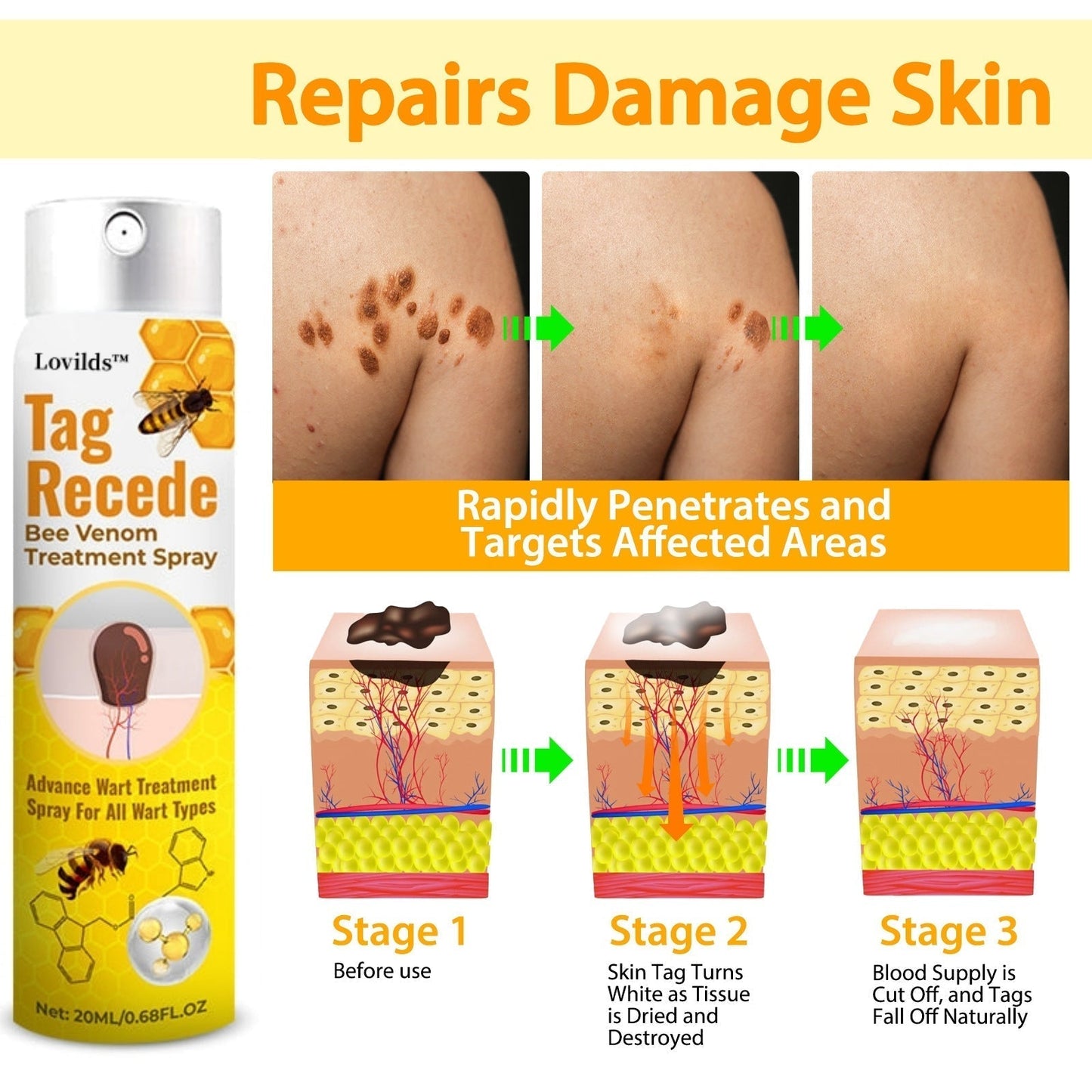 🐝LOVILDS TagRecede Bee Venom Treatment Spray