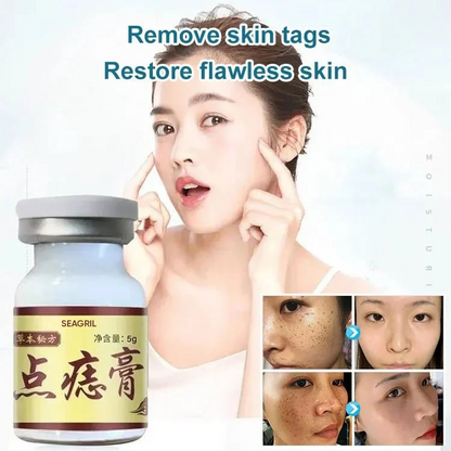 🔥LAST DAY 50% OFF🔥 - SEAGRIL-Concentrated Potent Skin Tag Removal Cream