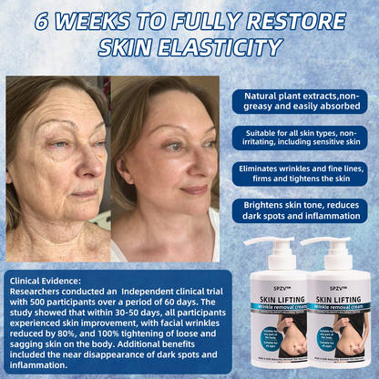 𝐋𝐚𝐬𝐭 𝐃𝐚𝐲 𝐃𝐢𝐬𝐜𝐨𝐮𝐧𝐭: 50% 𝐎𝐅𝐅✨𝑺𝑷𝒁𝑽™ 𝑺𝒌𝒊𝒏 𝑳𝒊𝒇𝒕𝒊𝒏𝒈 𝑾𝒓𝒊𝒏𝒌𝒍𝒆 𝑹𝒆𝒎𝒐𝒗𝒂𝒍 𝑪𝒓𝒆𝒂𝒎  Restore Skin Elasticity - 2024💃