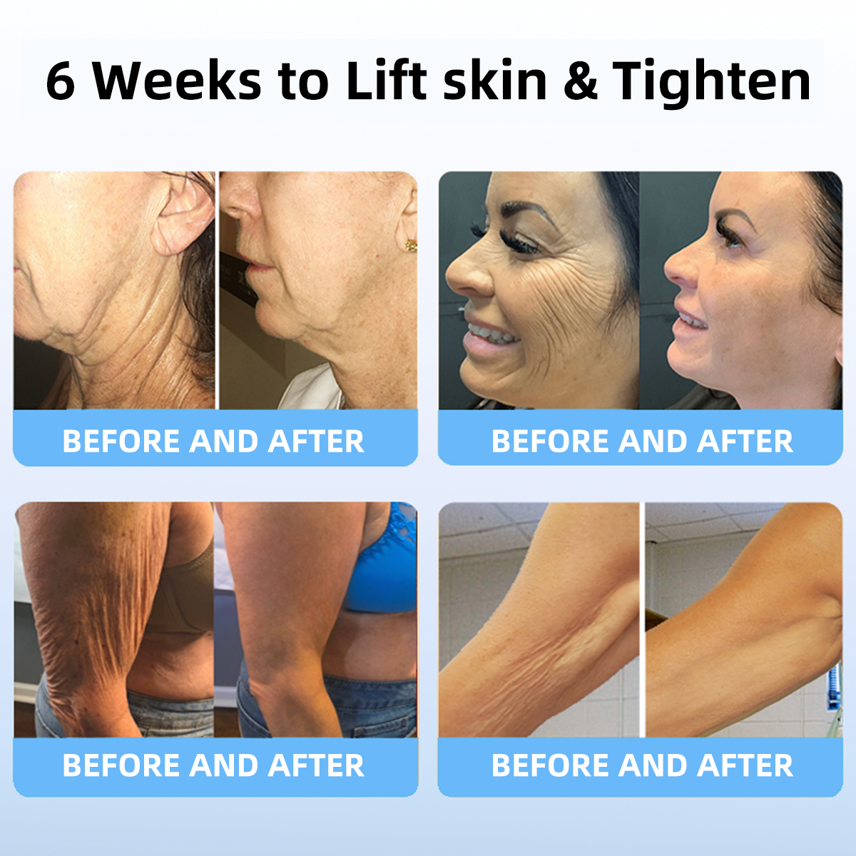 𝐋𝐚𝐬𝐭 𝐃𝐚𝐲 𝐃𝐢𝐬𝐜𝐨𝐮𝐧𝐭: 50% 𝐎𝐅𝐅✨𝑺𝑷𝒁𝑽™ 𝑺𝒌𝒊𝒏 𝑳𝒊𝒇𝒕𝒊𝒏𝒈 𝑾𝒓𝒊𝒏𝒌𝒍𝒆 𝑹𝒆𝒎𝒐𝒗𝒂𝒍 𝑪𝒓𝒆𝒂𝒎  Restore Skin Elasticity - 2024💃