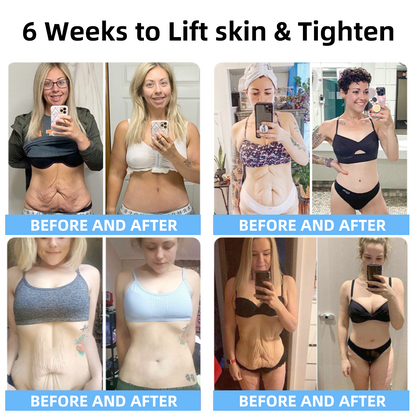 𝐋𝐚𝐬𝐭 𝐃𝐚𝐲 𝐃𝐢𝐬𝐜𝐨𝐮𝐧𝐭: 50% 𝐎𝐅𝐅✨𝑺𝑷𝒁𝑽™ 𝑺𝒌𝒊𝒏 𝑳𝒊𝒇𝒕𝒊𝒏𝒈 𝑾𝒓𝒊𝒏𝒌𝒍𝒆 𝑹𝒆𝒎𝒐𝒗𝒂𝒍 𝑪𝒓𝒆𝒂𝒎  Restore Skin Elasticity - 2024💃