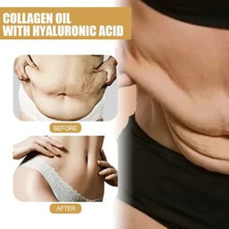Weight Loss Essential Oil