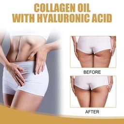 Weight Loss Essential Oil