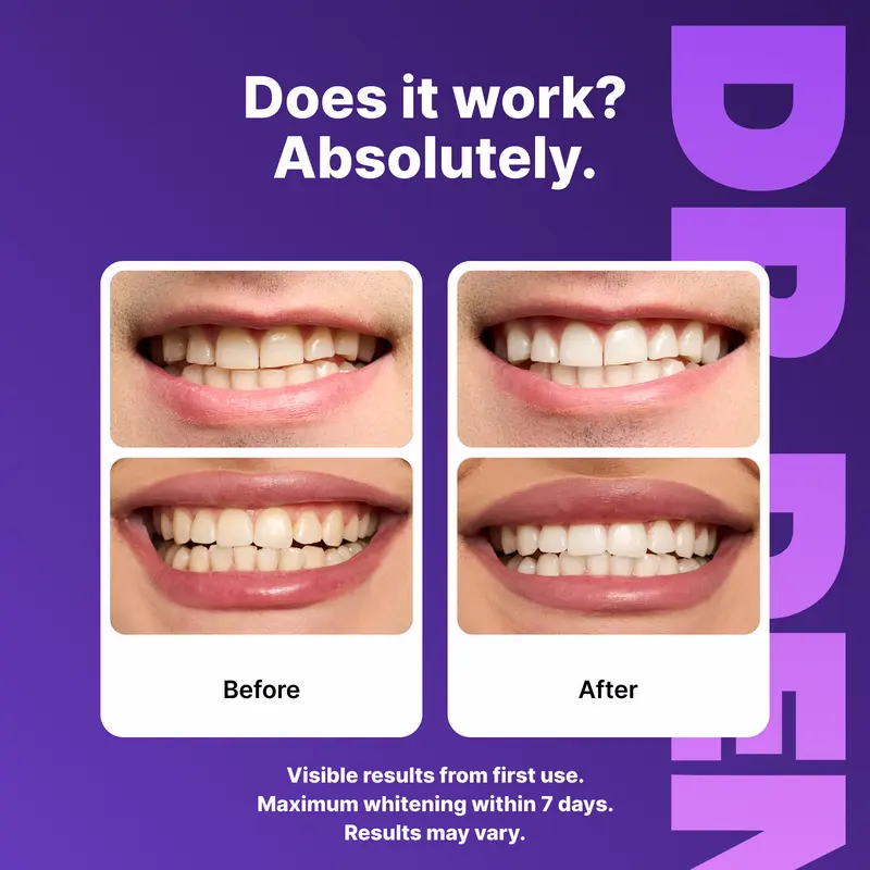 Purple Teeth Whitening Strips – 7 or 21 Sessions, Peroxide-Free, Enamel-Safe & Non-Sensitive Teeth Whitening