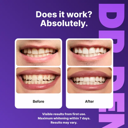 Purple Teeth Whitening Strips – 7 or 21 Sessions, Peroxide-Free, Enamel-Safe & Non-Sensitive Teeth Whitening