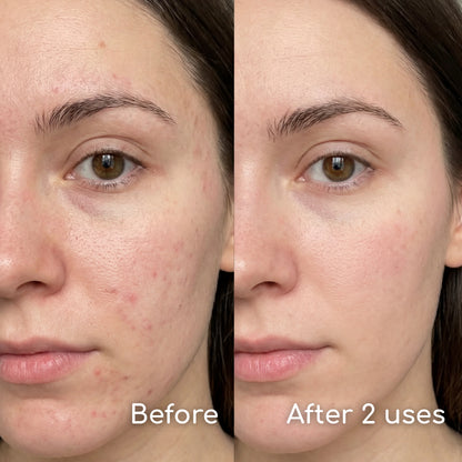 One patch. Whole face.