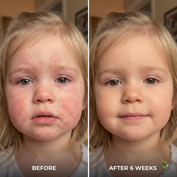 Skin Repair Serum