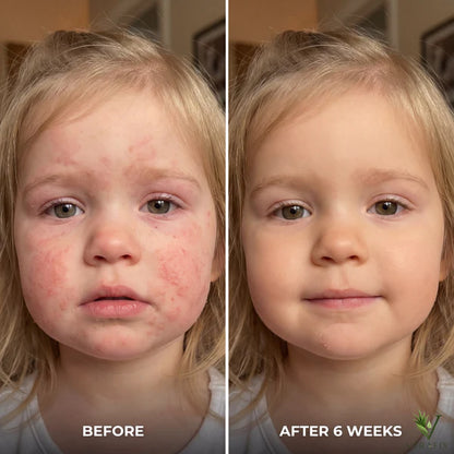 Skin Repair Serum