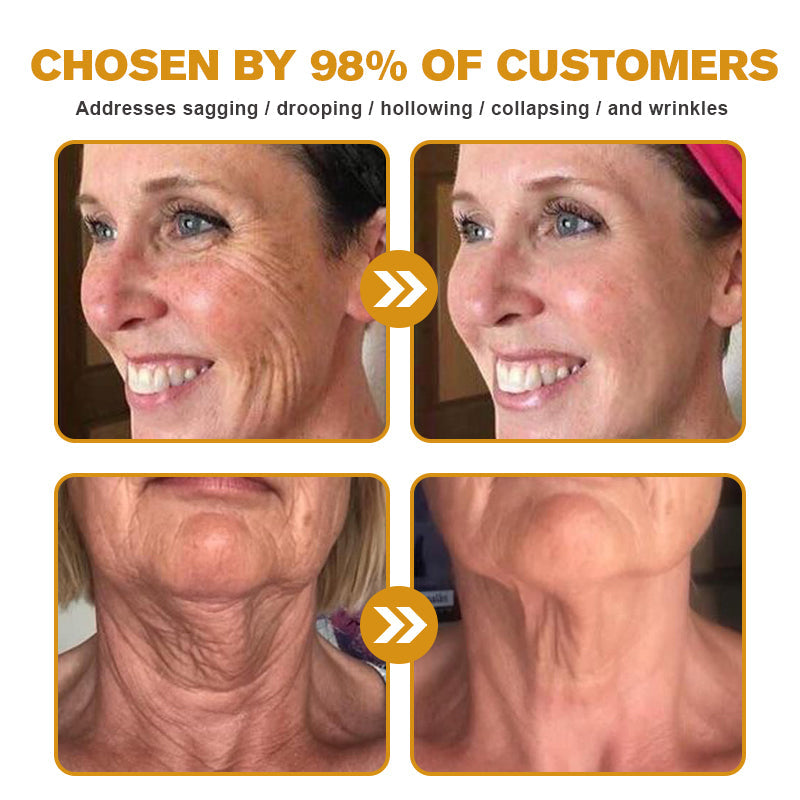 Furzero Botox Bee Venom Wrinkle Removal Cream