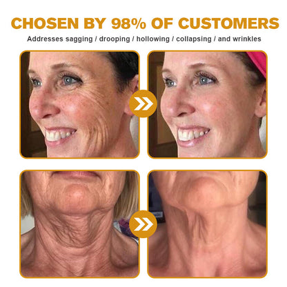 Furzero Botox Bee Venom Wrinkle Removal Cream