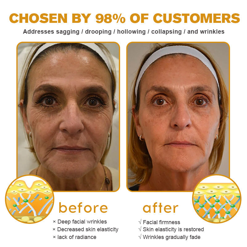 Furzero Botox Bee Venom Wrinkle Removal Cream