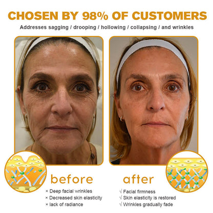 Furzero Botox Bee Venom Wrinkle Removal Cream