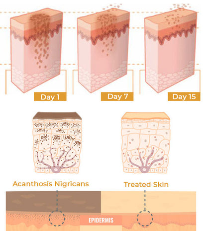 NigriCare Therapy Drops